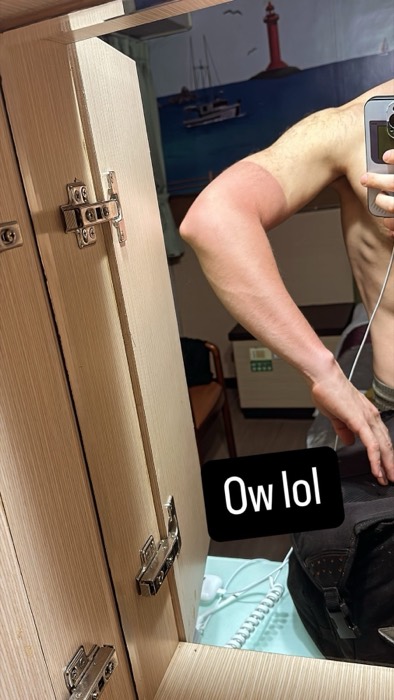 Joshua: mirror shot of harsh cycling sunburn line on arm